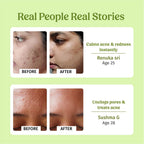 Sensitive Skin Combo