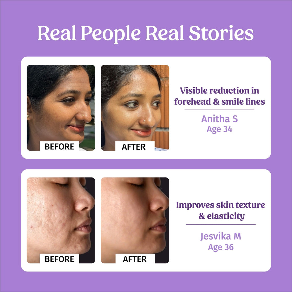 40ml Better Ageing Serum