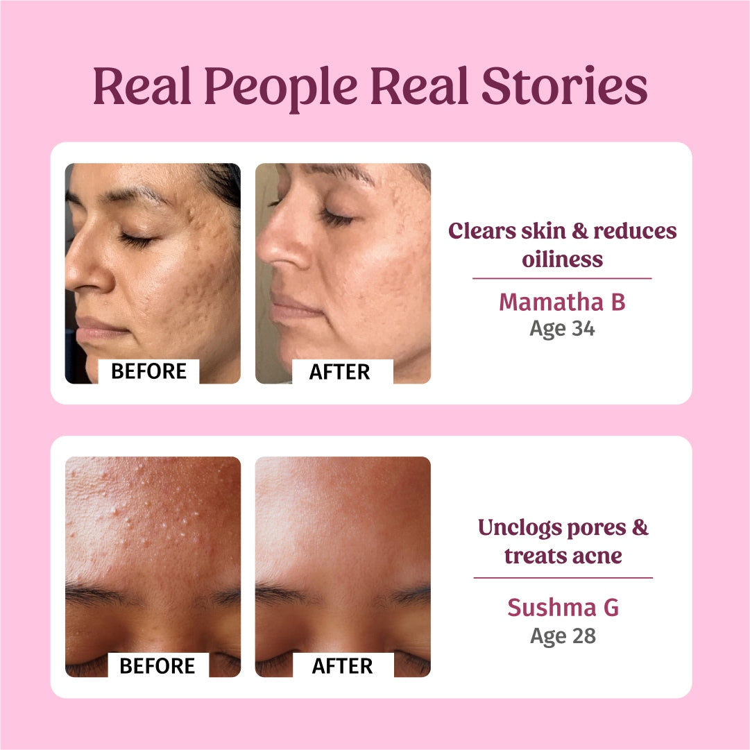 Rose Water Facial Toner