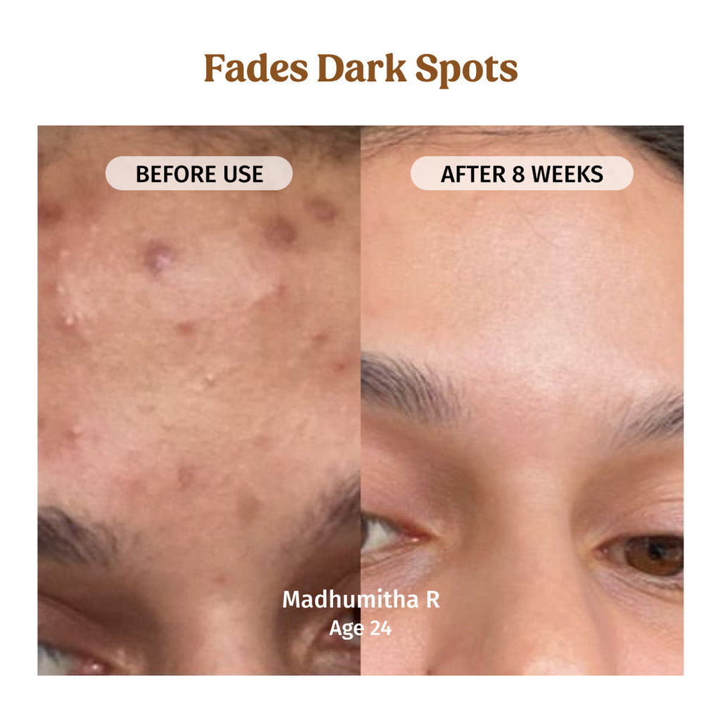 Milk Drops Brightening Serum