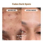 Milk Drops Brightening Serum