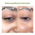 Under Eye Cream (Dark Circles Control)